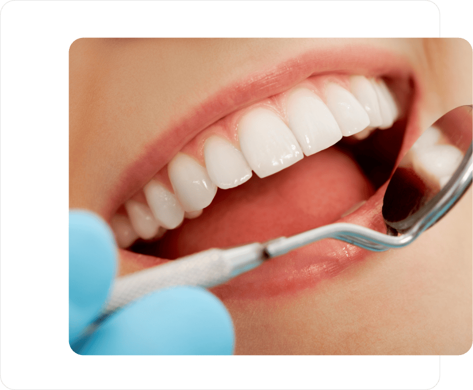 A dentist looking into a patients mouth as placed by Fill-ins Locum Agency
